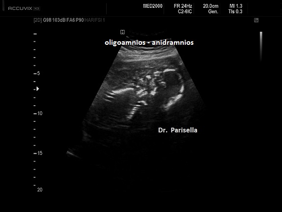 come i liquidi densi e consistenti Diabete gestazionale: riconoscerlo, capirlo e affrontarlo main image 0